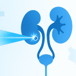 A New Era for Urological Care: Introducing Advanced Laser Technology in Kenya